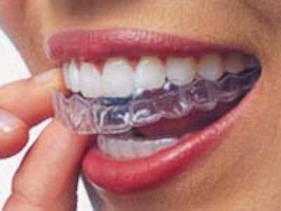 East Palo Alto Invisalign Services