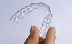 Invisalign Braces